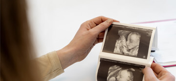 pro-tüp-bebek-embriyo-donasyonu-3